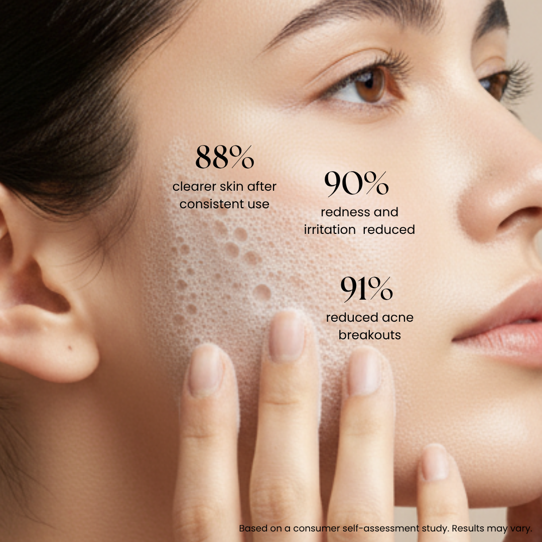 Acne Guard  Face Cleanser-100 ml