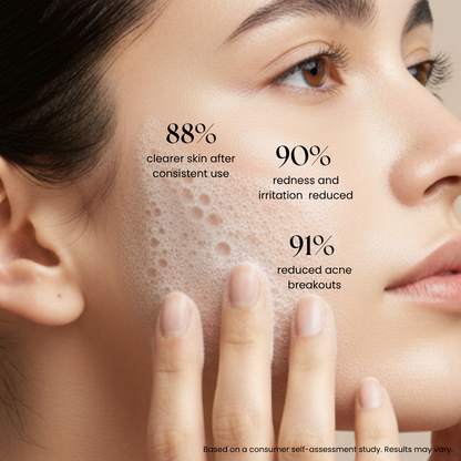 Acne Guard  Face Cleanser-100 ml